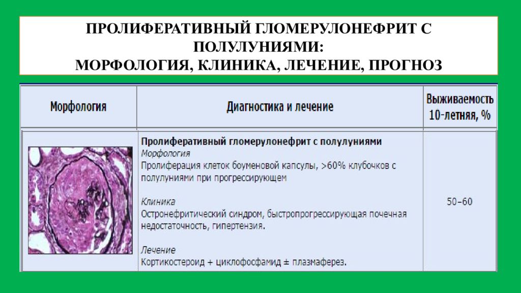 Пролиферативный. Пролиферативные формы гломерулонефрита. Морфологические формы гломерулонефрита. Морфологические формы хронического гломерулонефрита. Пролиферативный гломерулонефрит классификация.