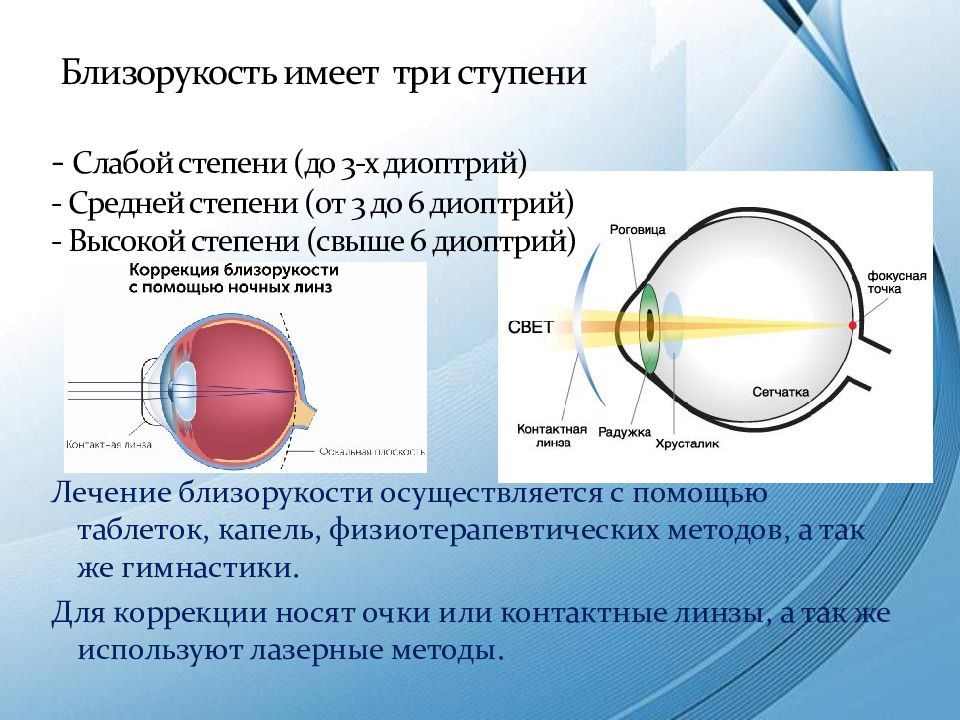 У близоруких людей изображение фокусируется