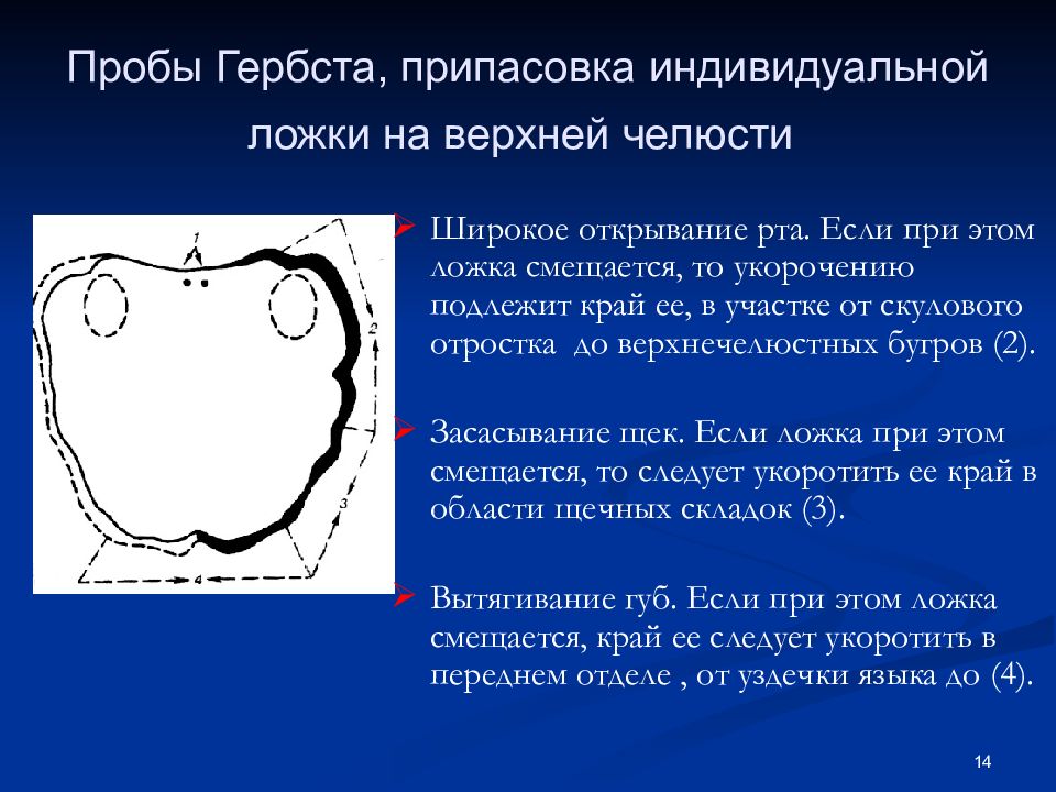 Индивидуальные ложки в ортопедической стоматологии презентация