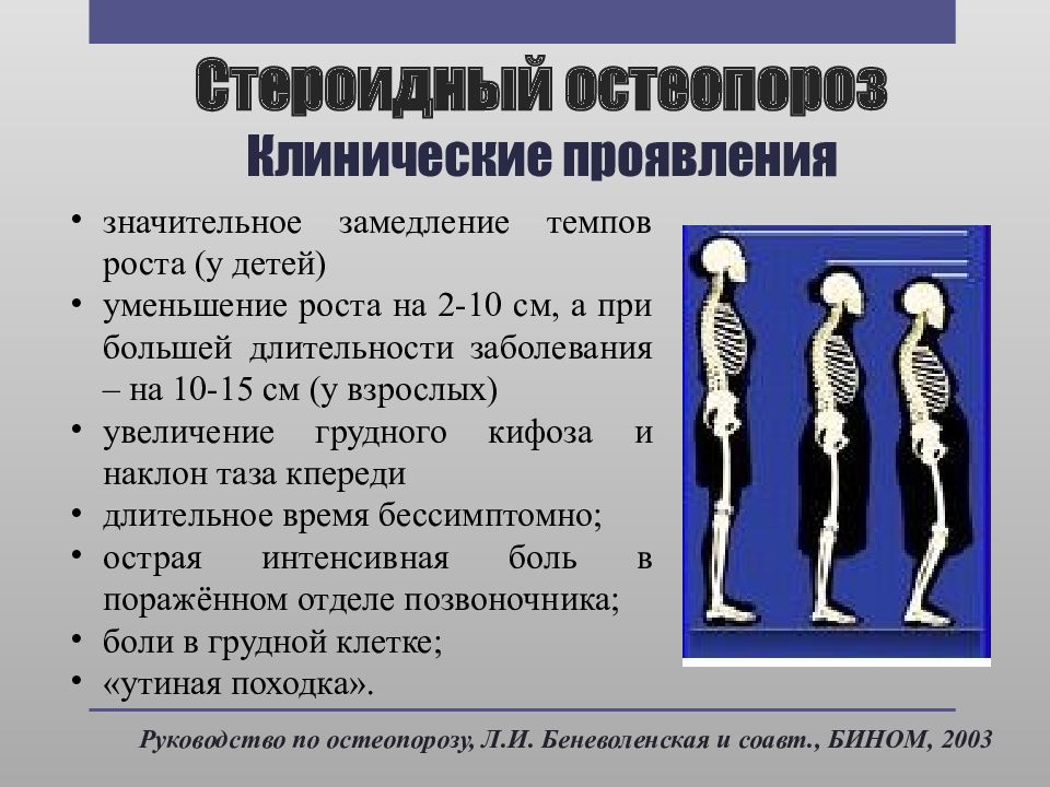 Вторичный остеопороз. Стероидный остеопороз. Клинические проявления остеопороза. Клиническое проявление остеопороза снижение роста. Профилактика стероидного остеопороза.