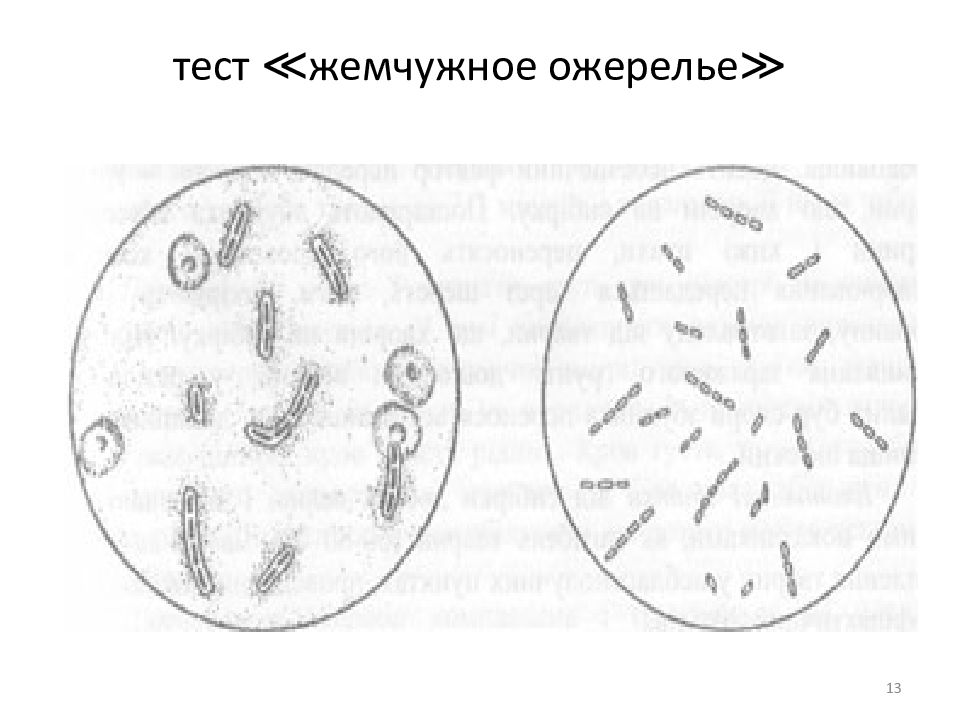 Тест на чуму