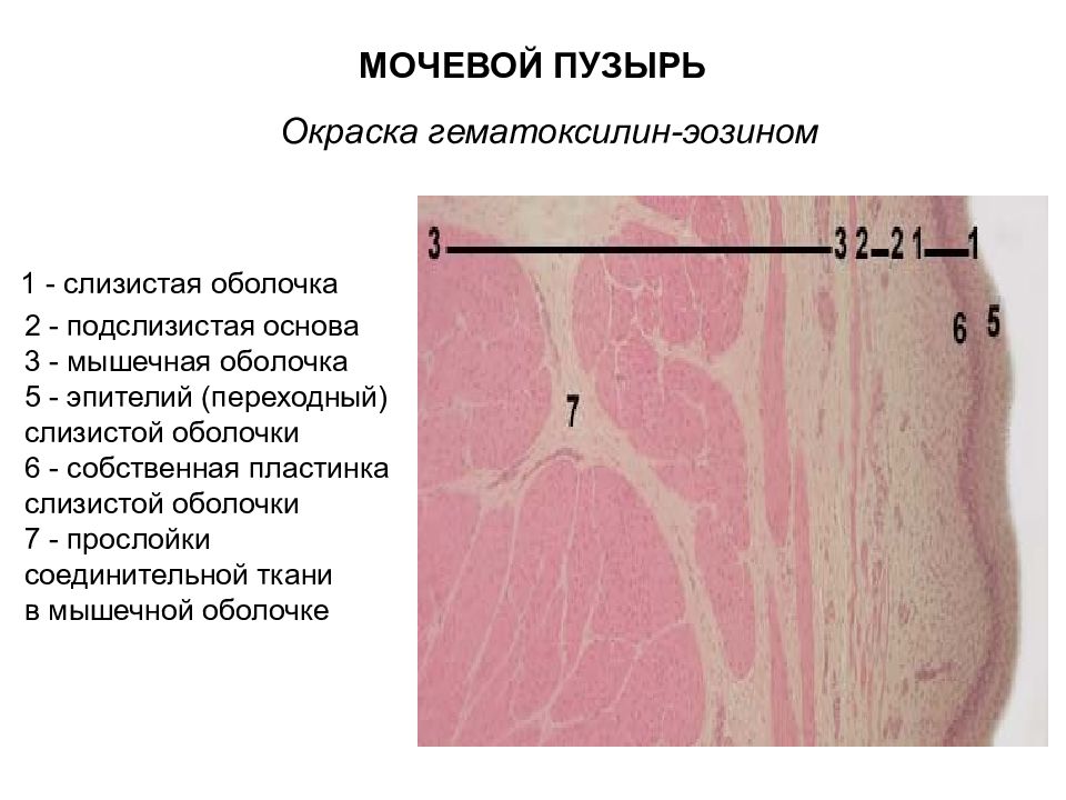 Стенка мочевого пузыря гистология. Мочевой пузырь окраска гематоксилин-эозином. Гистологический препарат мочевой пузырь. Строение мочевого пузыря гистология препарат.