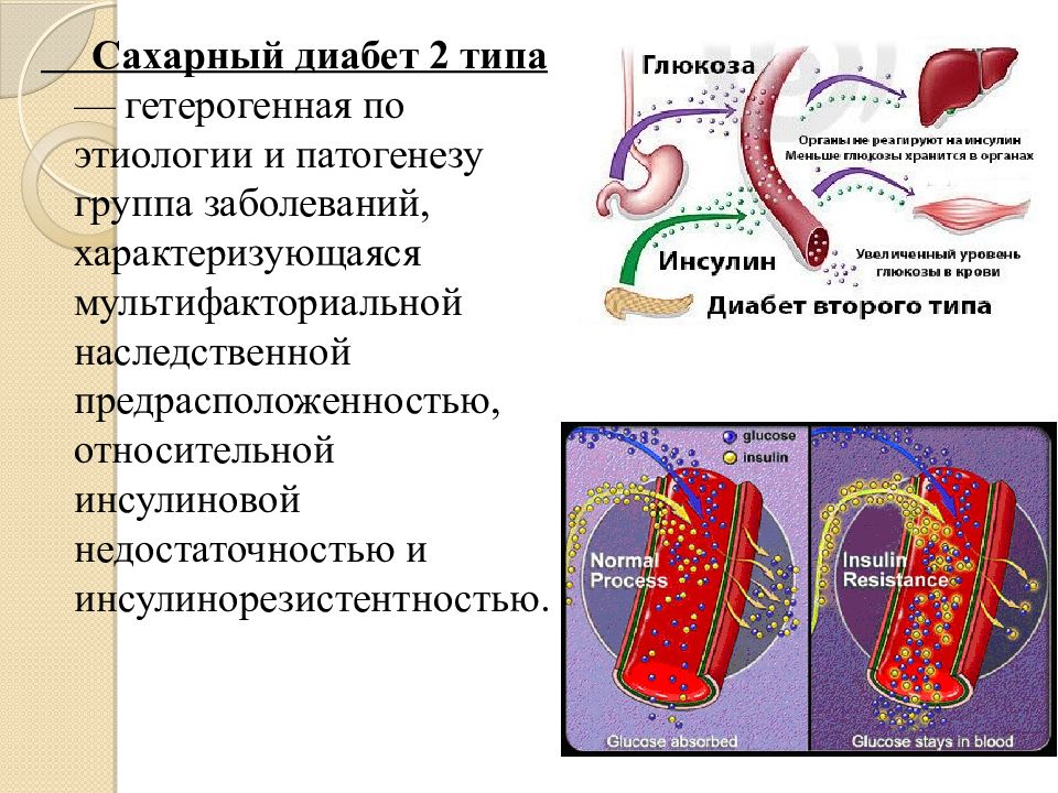 Картинки про сахарный диабет 2 типа