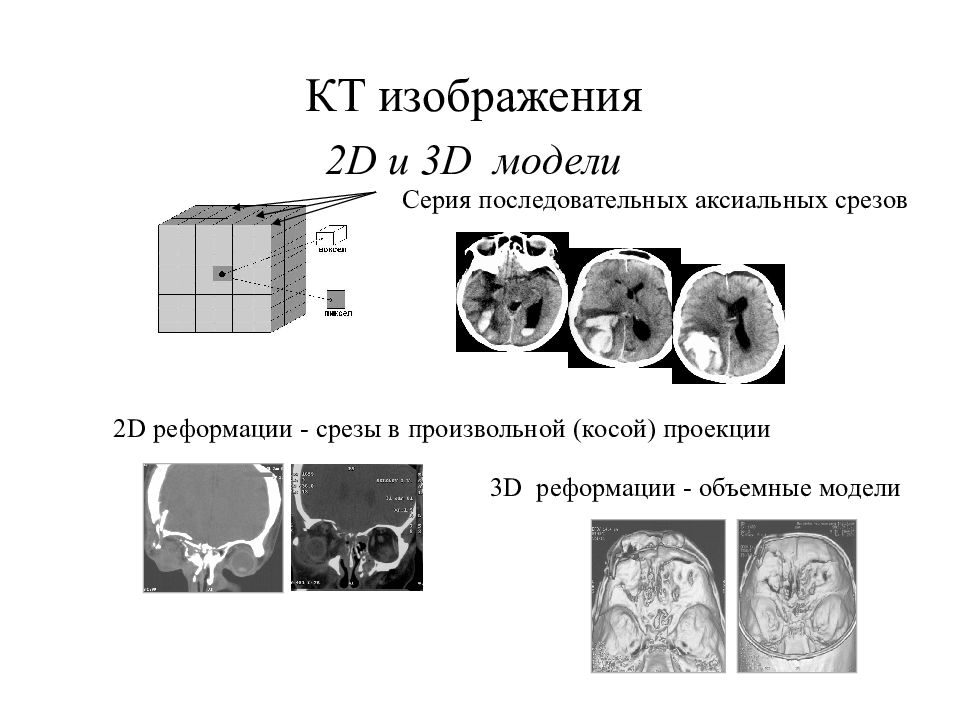 Распечатка кт изображения на пленке