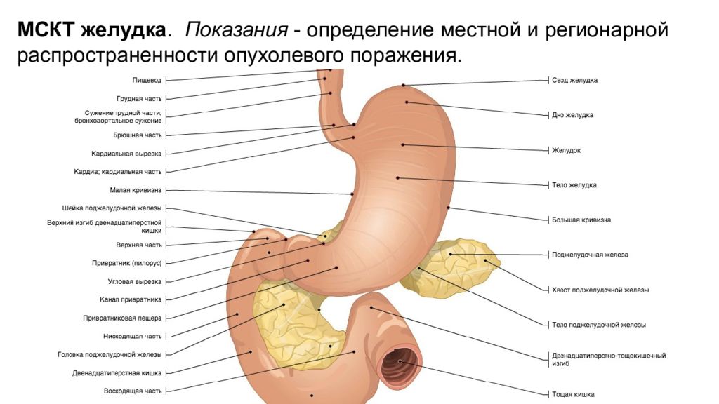 Сделать кт желудка. Анатомия желудка человека на кт. Укажите части желудка.