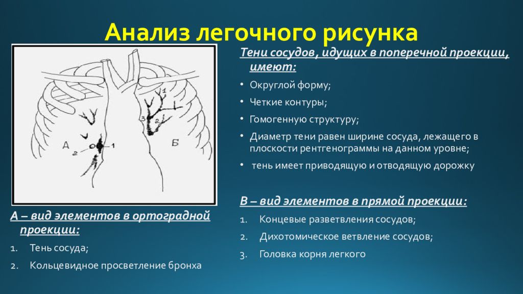 Легочно сосудистый рисунок усилен. Анализ легочного рисунка. Легочный рисунок в норме. Легочный рисунок в норме и патологии. Структуры легочного рисунка.