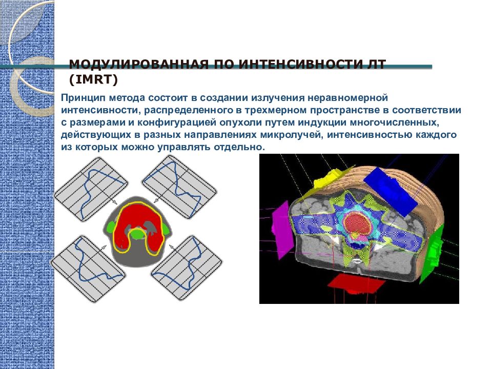 Планирование лучевой терапии презентация