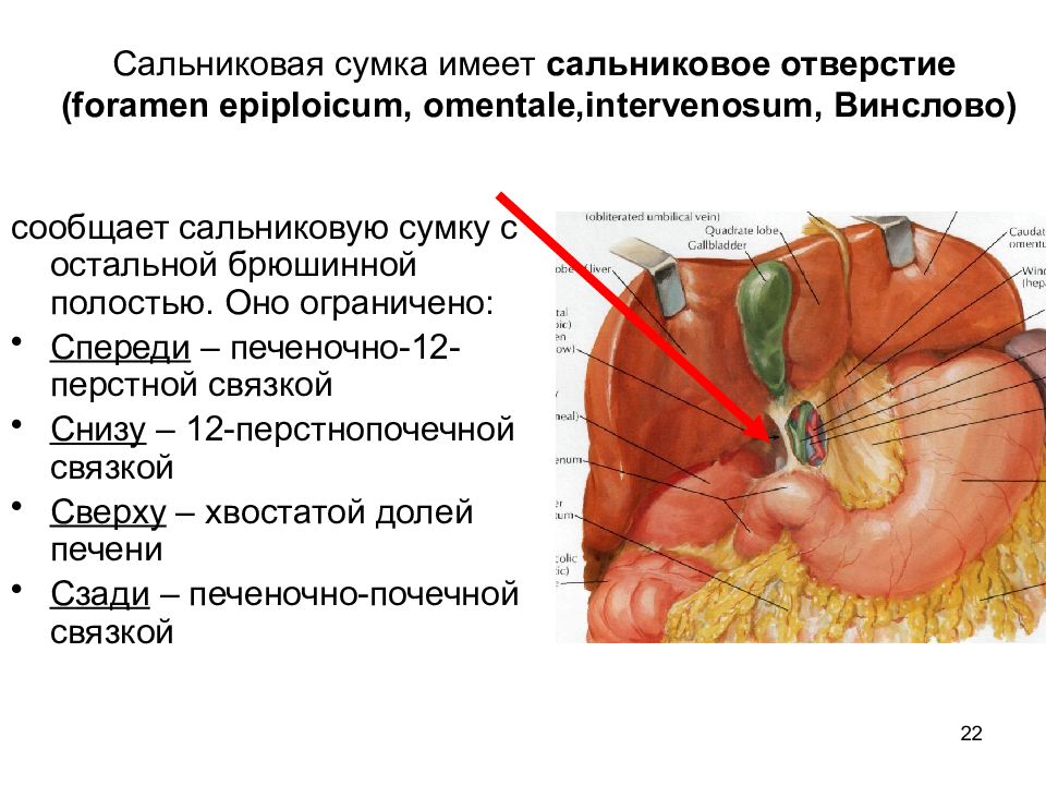 Печеночная сумка. Анатомия поджелудочной железы сальниковая сумка. Абсцесс сальниковой сумки. Печеночно 12 перстная связка. Вскрытие сальниковой сумки.