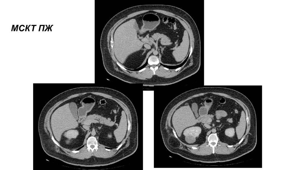 Мскт полости. Кт брюшной полости облучение. Лучевая нагрузка при кт брюшной полости. Итеративная реконструкция кт-изображений. Кт брюшной полости презентация.