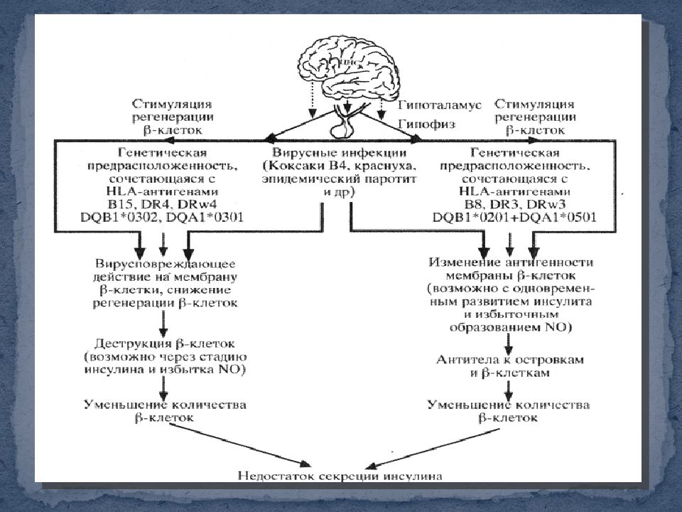 Патогенез сахарного диабета 1 типа схема