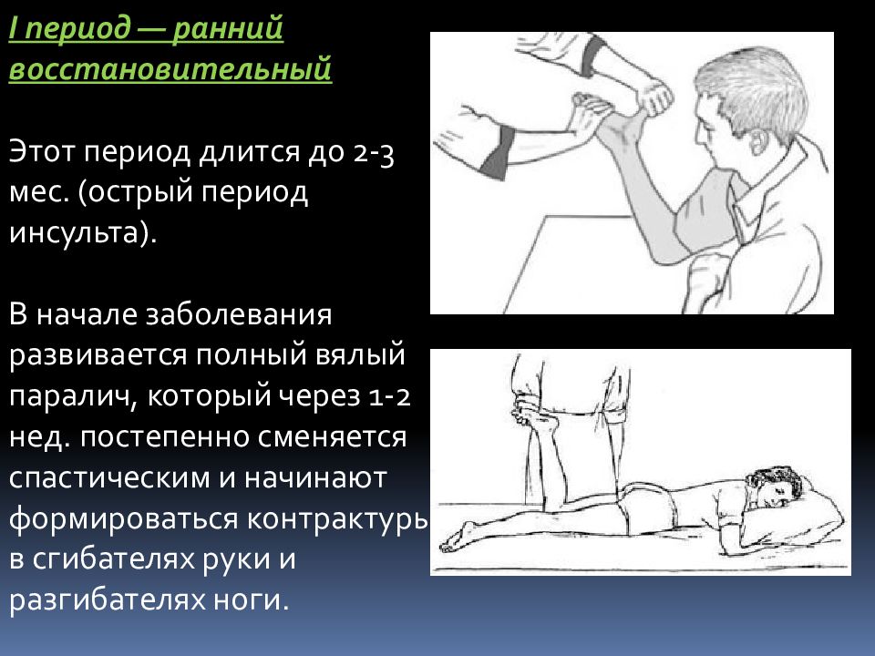 Ранний восстановительный период после инсульта