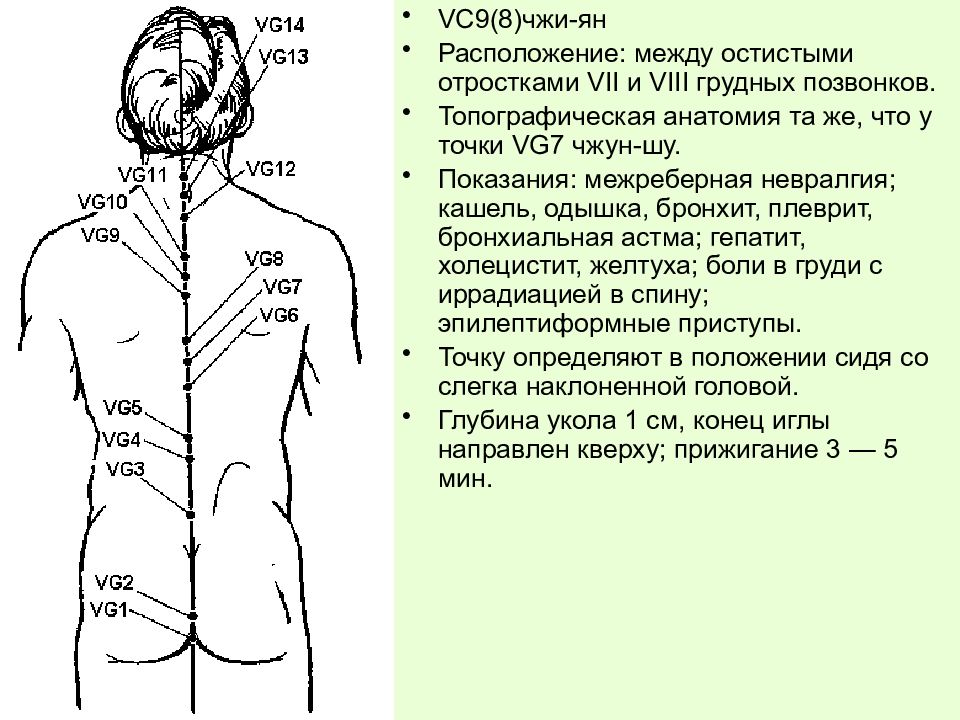 Точка 14. Переднесрединный Меридиан расположение точек. Переднесрединный Меридиан болит. Заднесрединный Меридиан точка vg2. Точка Чжун Шу заднесрединного меридиана.