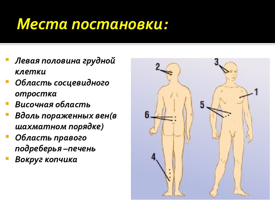 Методы физиотерапии презентация. Места постановки Хумиры. Простейшие физиотерапевтические процедуры презентация. Места постановки Магина. Места постановки ангиокатов.