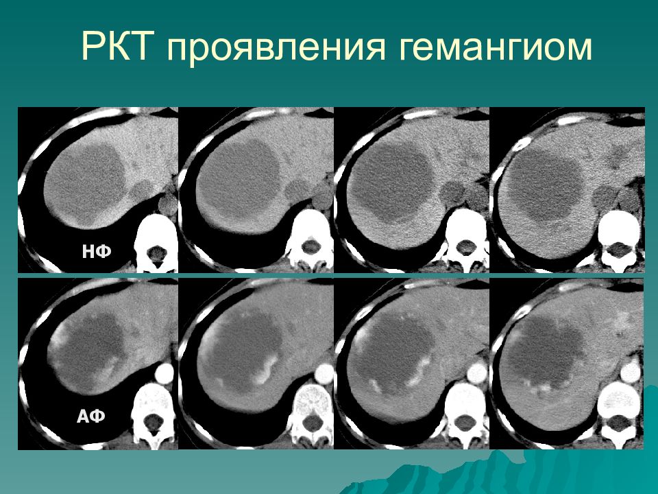 Ркт 6