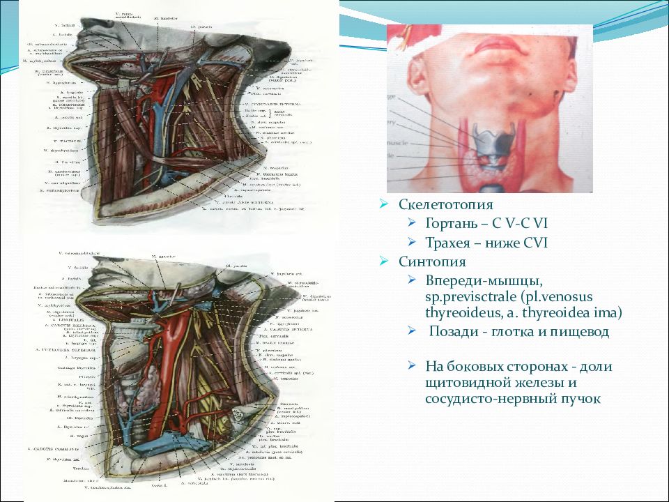 Топографическая анатомия и оперативная хирургия шеи презентация