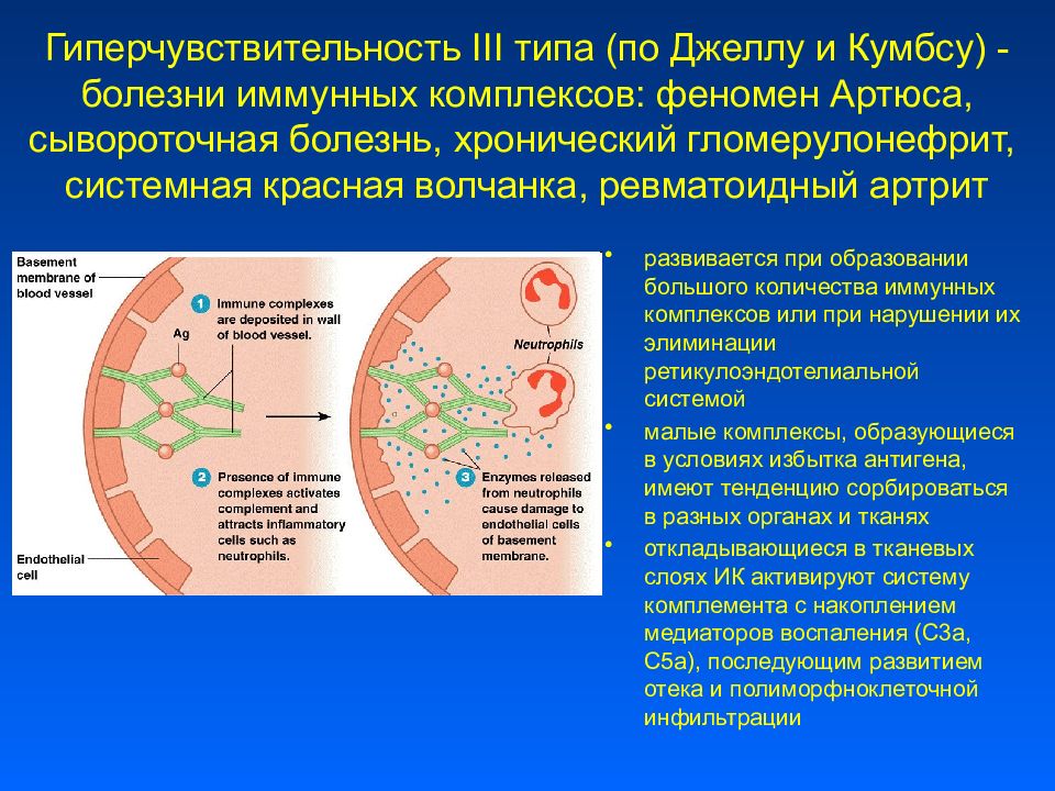 Типы гиперчувствительности. Болезни иммунных комплексов сывороточная болезнь. 3 Тип по Джеллу-Кумбсу. Гиперчувствительность i типа по Джеллу и Кумбсу. Гиперчувствительность 3 типа иммунология.