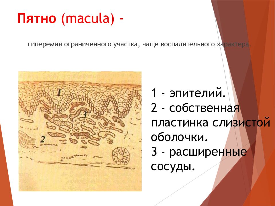 Пятно ( macula ) -