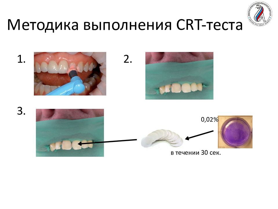 Косрэ тест. Тэр тест стоматология. Тэр тест методика.