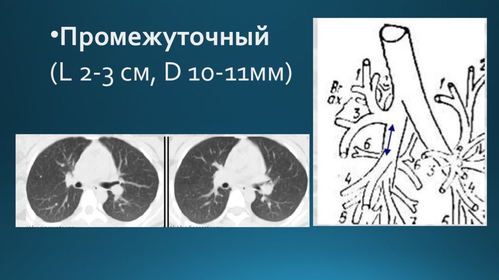 Лучевая диагностика органов дыхания презентация