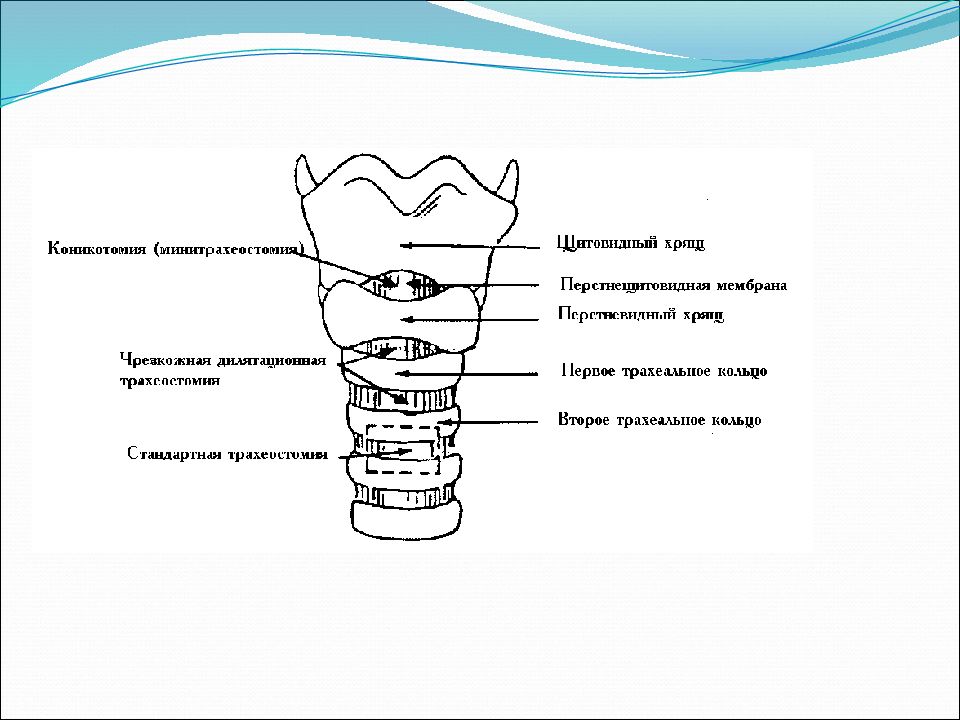 Топографическая анатомия и оперативная хирургия шеи презентация