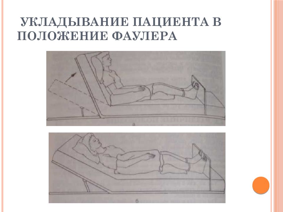 Положение пациента в постели. Положение тела больного Фаулера. Положение Фаулера пациент. Биомеханика тела положение Фаулера. Придание пациенту положения Фаулера.