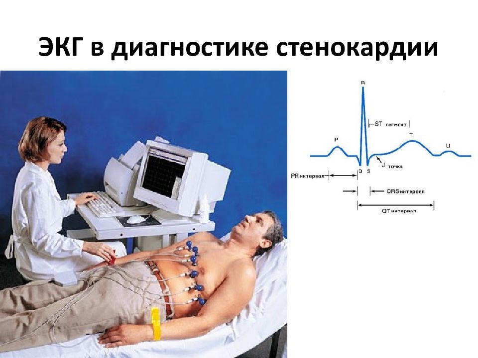 Методы обследования в кардиологии презентация