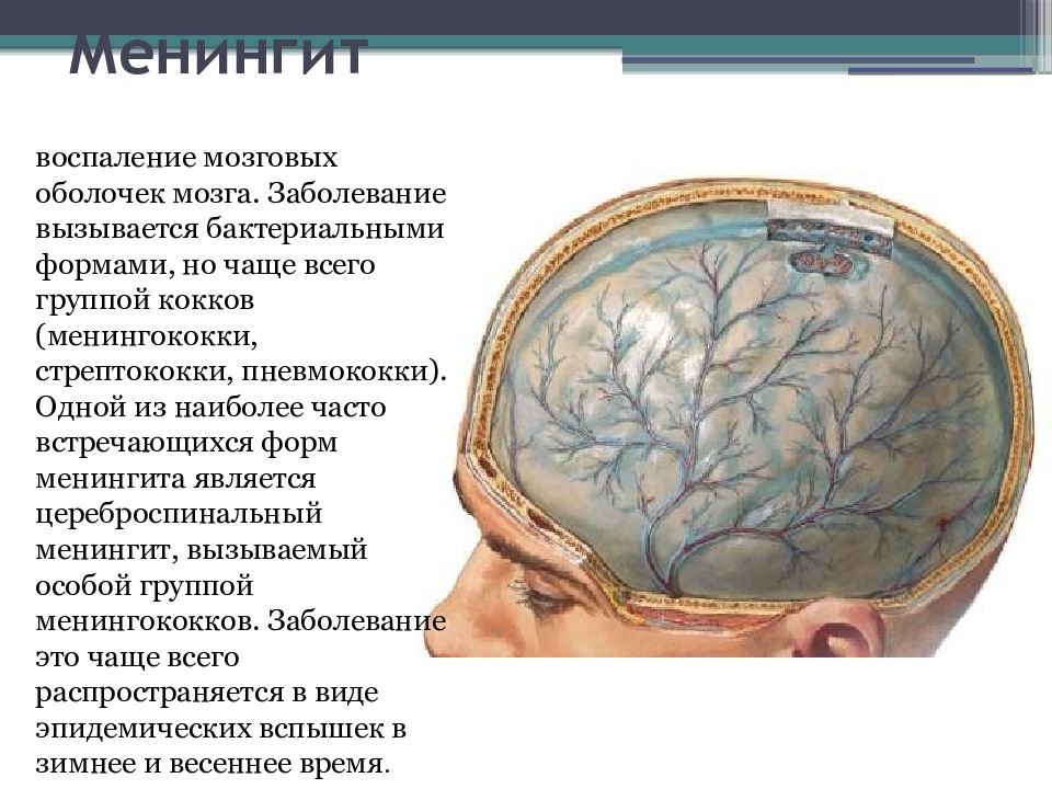 Менингит и энцефалит презентация