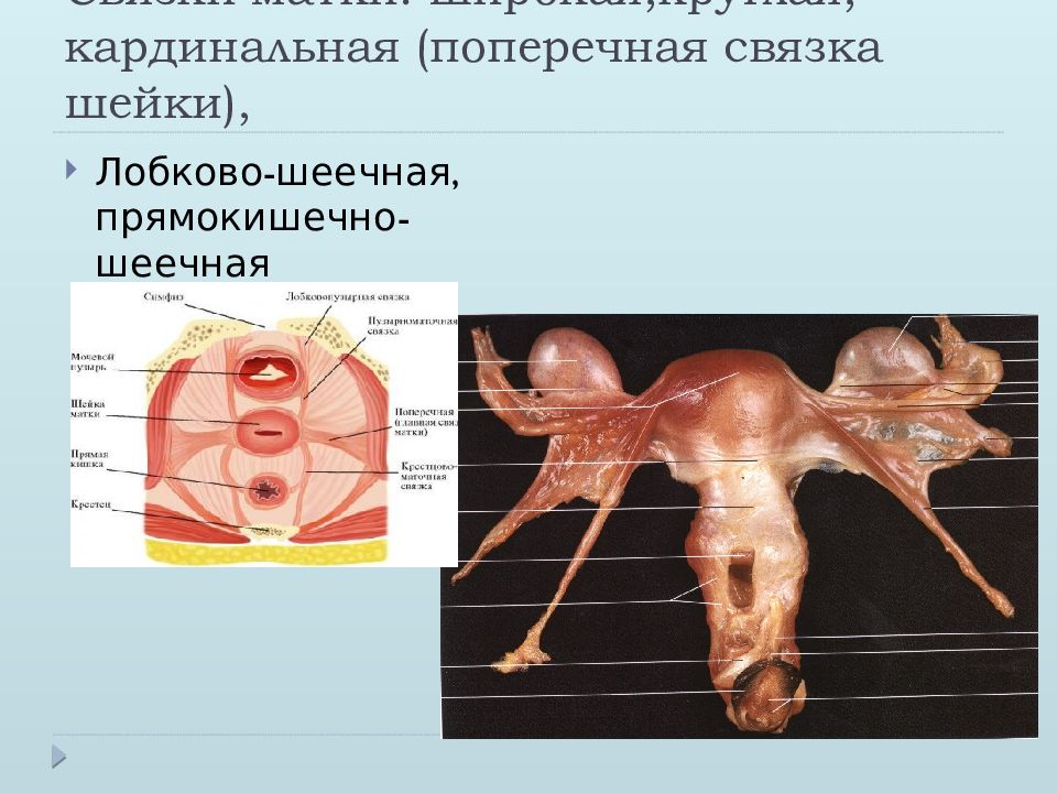 Связка подвешивающая яичник. Связочный аппарат матки анатомия. Прямокишечная маточная связка. Топография матки. Фиксирующий аппарат.