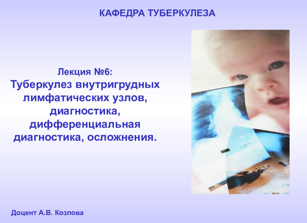 Лекция №6: Туберкулез внутригрудных лимфатических узлов, диагностика,