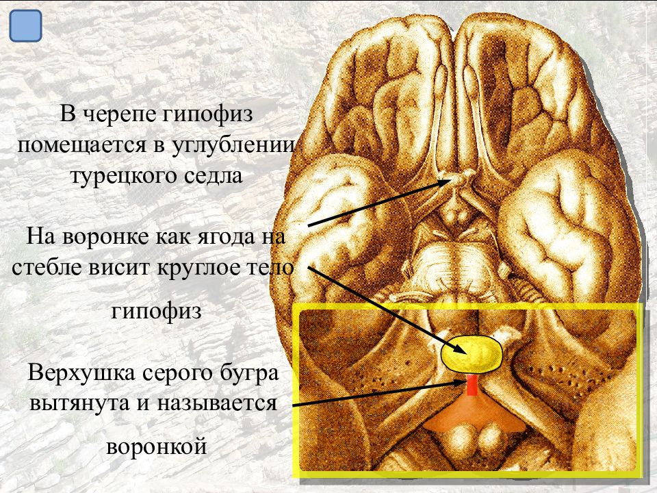 Головной мозг турецкий. Сосцевидные тела головного мозга. Сосцевидные тела гипоталамуса. Сосцевидное тело промежуточный мозг. Серый бугор головного мозга.