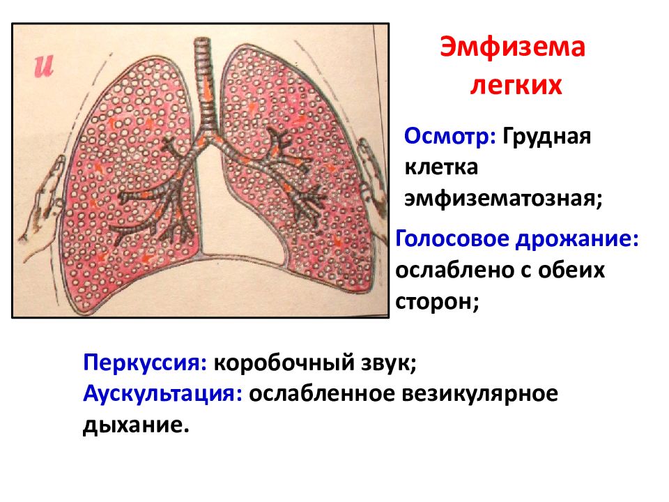 Методы легких