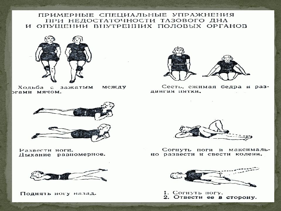 Особенности лфк при хроническом пиелонефрите презентация