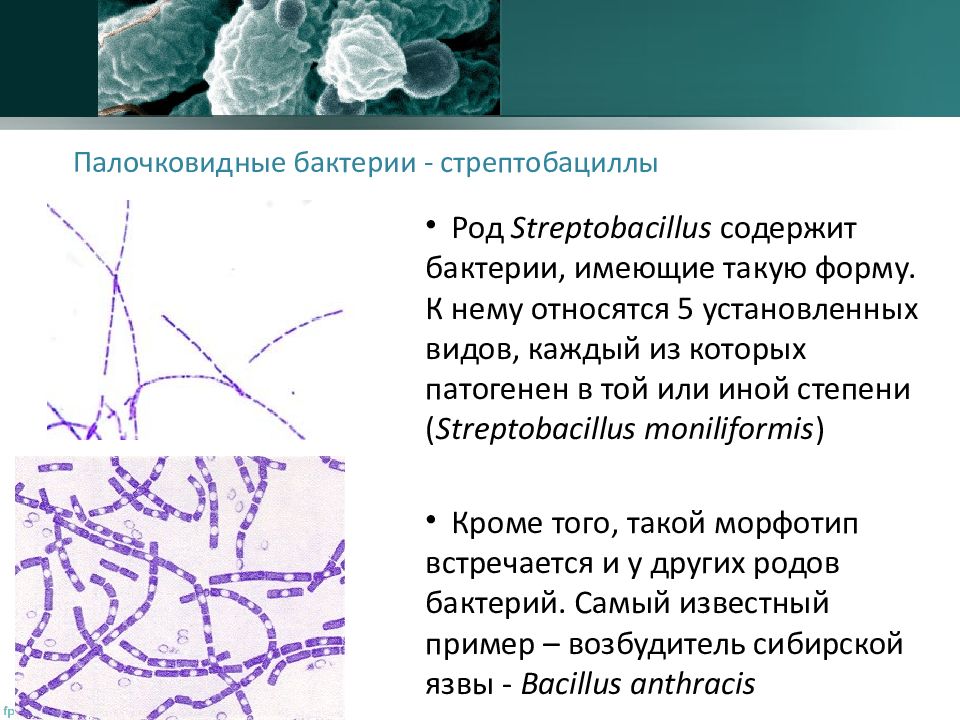 Палочковидные. Морфология палочковидных бактерий. Стрептобацилла морфология. Палочковидные бациллы морфология. Стрептобацилла морфология микробиология.