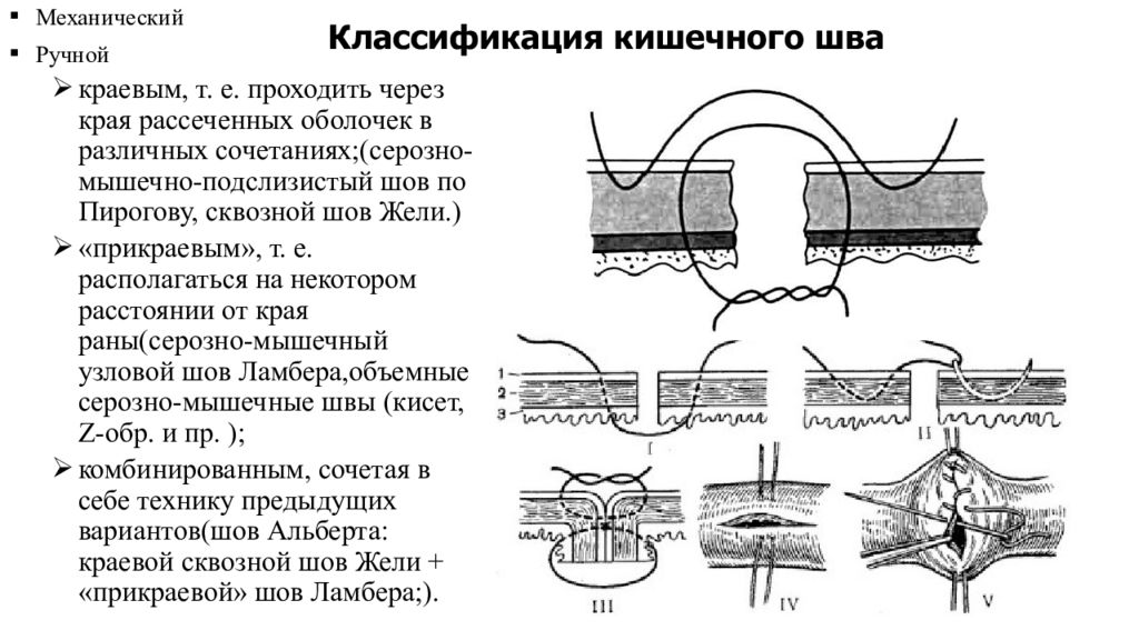 Шов нерва презентация