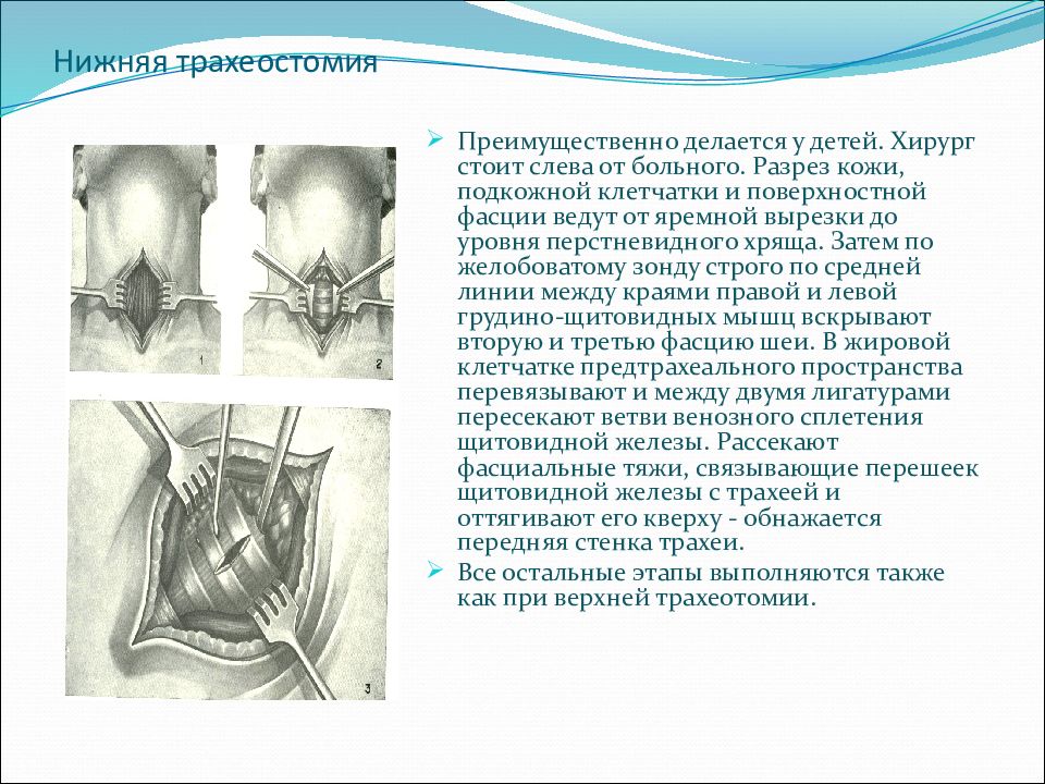 Операция нижняя