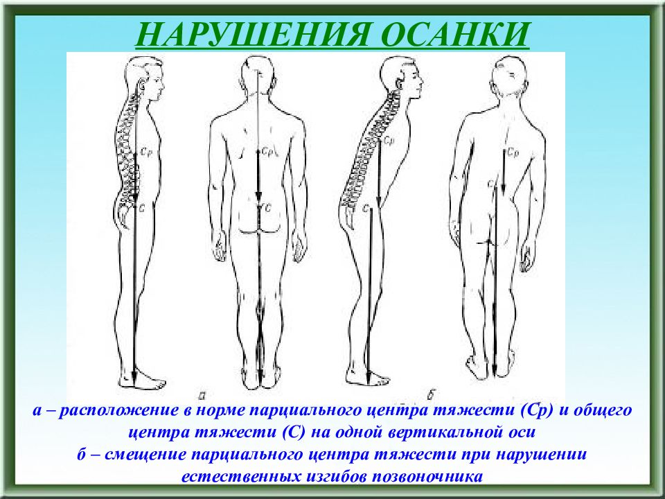 Нормальное расположение. Смещение центра тяжести. Смещение центра тяжести у человека. Осанка и центр тяжести. Вертикальная ось позвоночника.