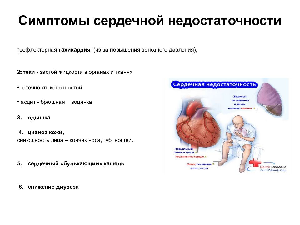 Сердечная недостаточность симптомы. Кашель при сердечной недостаточности симптомы. Сердечная недостаточность симптомы 3 тон.