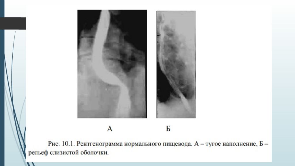 Рентгенография желудка презентация