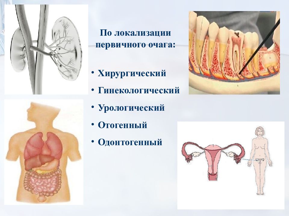 Презентация по хирургии сепсис