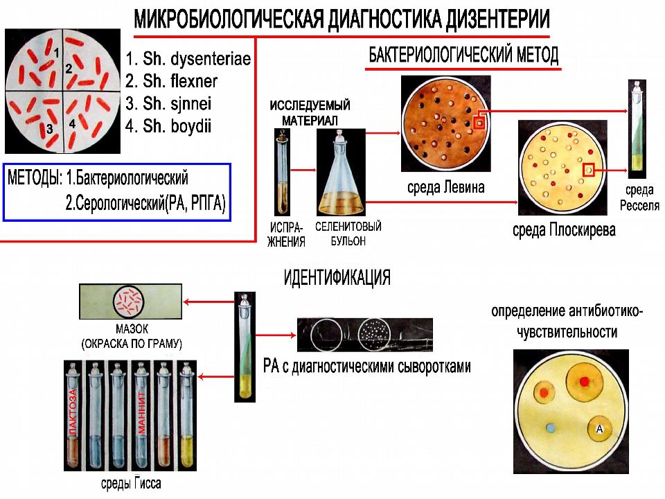 Диагностика микробиология. Схема лабораторной диагностики шигелл. Бактериологический метод диагностики шигелл. Методы микробиологической диагностики шигеллеза. Бактериологический метод исследования шигелл.