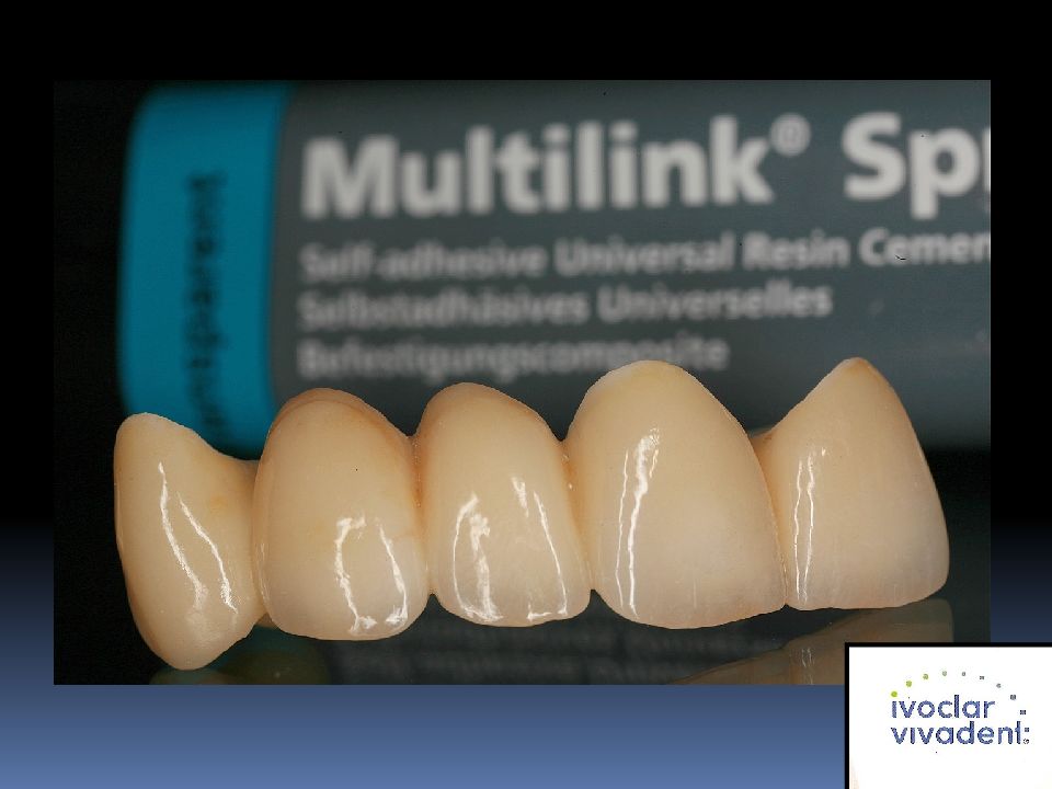 безметалловая керамика диоксид циркония. керамическая коронка цельноциркониевая prettau. диоксид циркония коронки. диоксид циркониевая коронка. коронка диоксид цирконий и е мах.