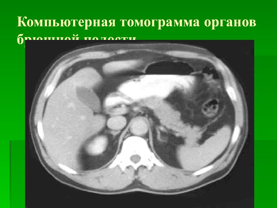 Мс кт. Кт брюшной полости презентация. Показания кт и мрт органов брюшной полости. Основные понятия кт.