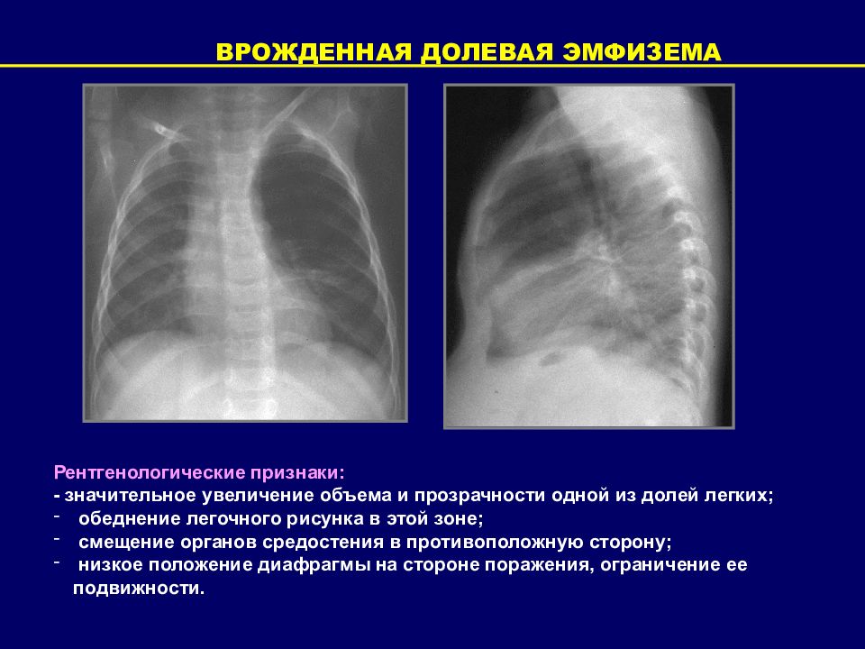 Лучевая диагностика средостения презентация