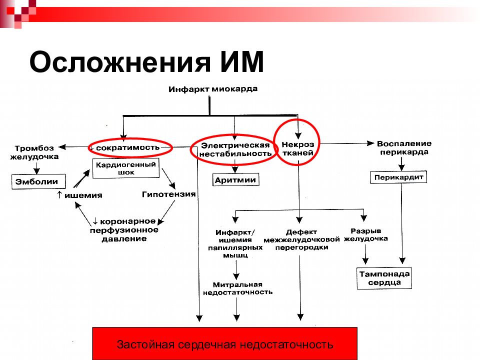 Схема лечения инфаркта миокарда