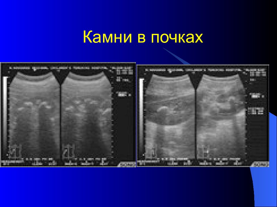 Лучевая диагностика брюшной полости презентация