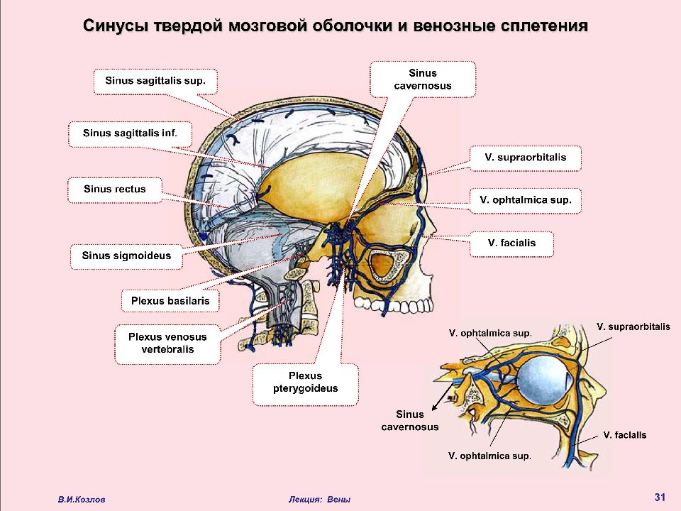 Синус оболочки мозга. Венозные синусы твердой оболочки головного мозга. Синусы синусы твердой мозговой оболочки. Синусы твердой оболочки головного мозга схема. Синусы твёрдой мозговой оболочки топографическая.