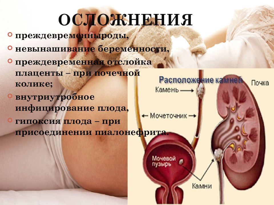 Заболевания мочевыделительной системы и беременность презентация