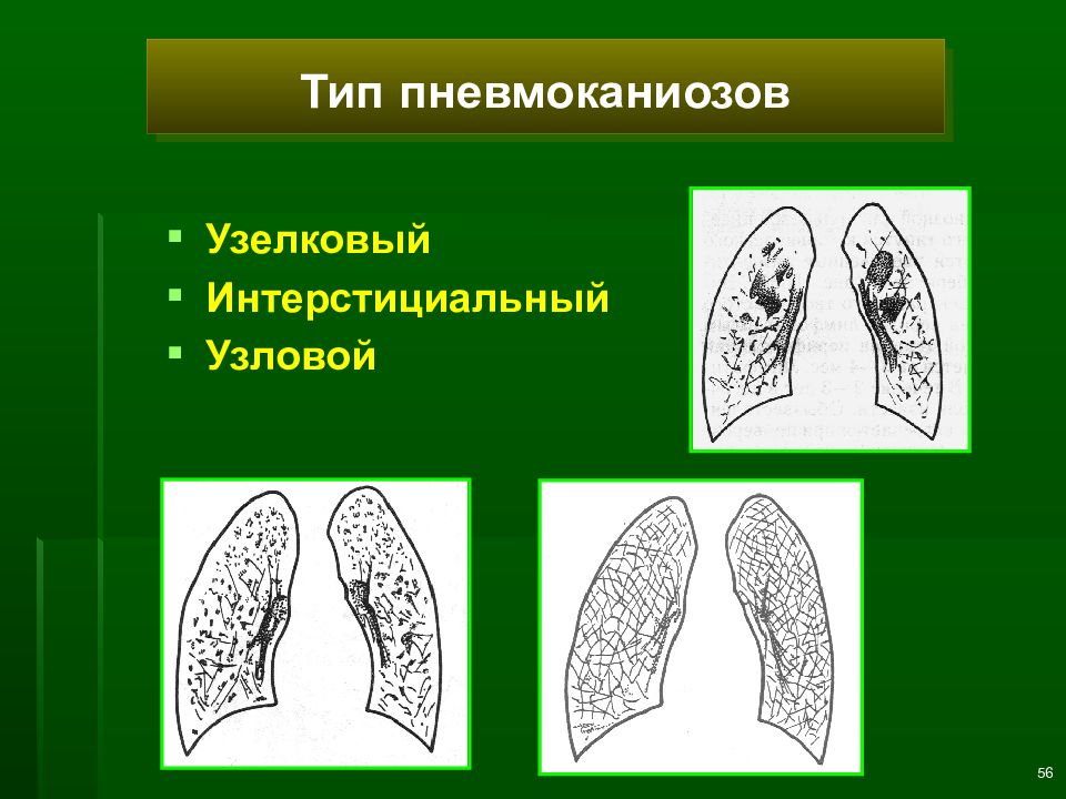 Лучевая диагностика заболеваний легких презентация