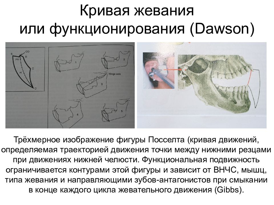 Вариант зонографии позволяющий получить развернутое плоскостное изображение челюстей