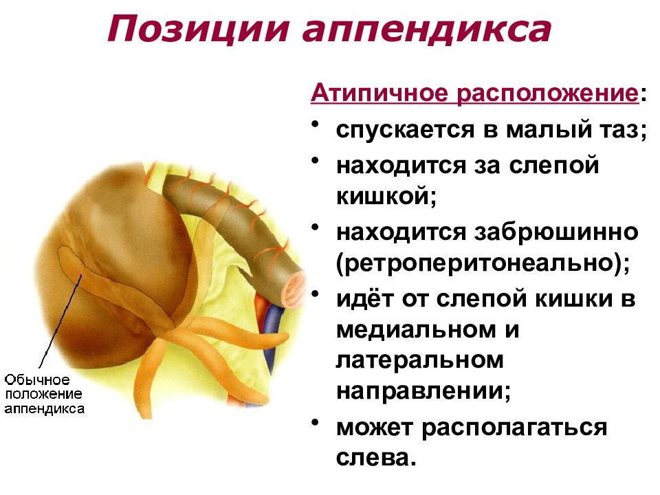 Синдром острого живота презентация